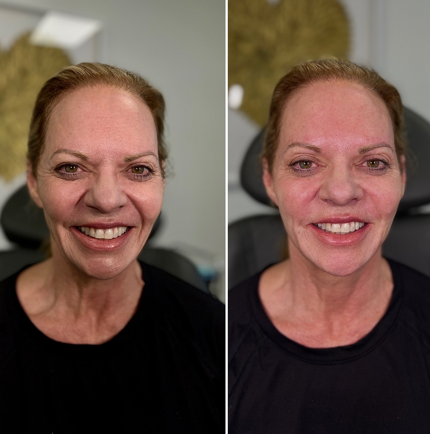  Scupltra Before & After