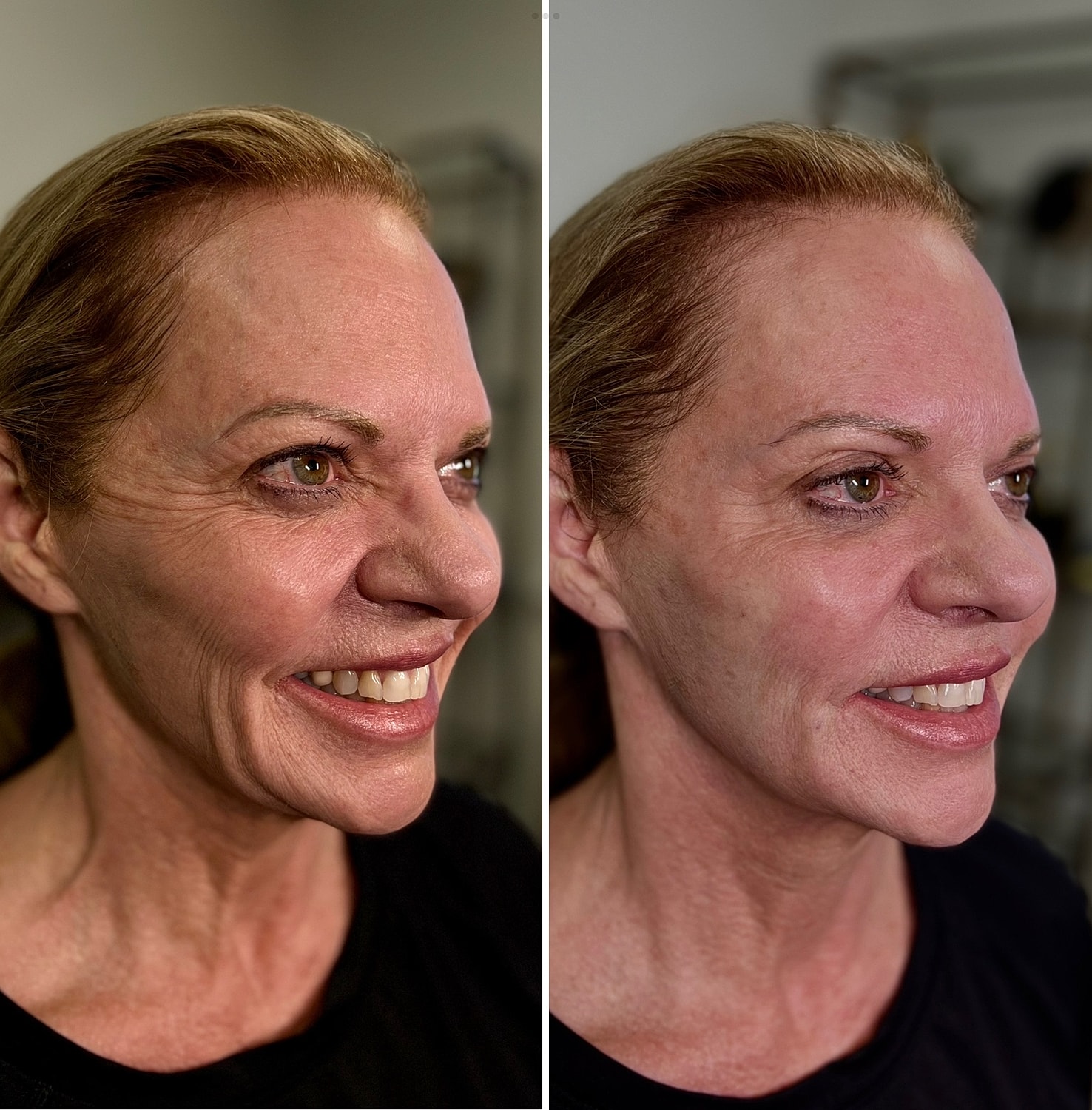  Scupltra Before & After